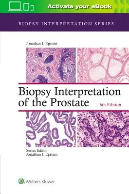 Interpretace biopsie prostaty - Biopsy Interpretation of the Prostate