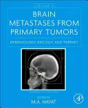 Mozkové metastázy z primárních nádorů, 2. díl: Epidemiologie, biologie a terapie - Brain Metastases from Primary Tumors, Volume 2: Epidemiology, Biology, and Therapy