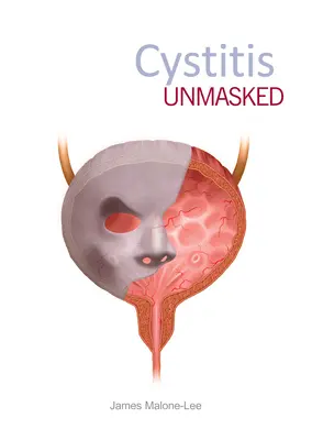 Odhalená cystitida - Cystitis Unmasked
