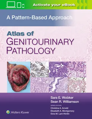 Atlas genitourinární patologie: A Pattern Based Approach (Přístup založený na vzorcích) - Atlas of Genitourinary Pathology: A Pattern Based Approach