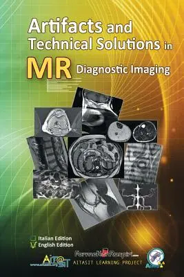 Artefakty a technická řešení v diagnostickém zobrazování pomocí magnetické rezonance - Artifacts and Technical Solutions in MR Diagnostic Imaging