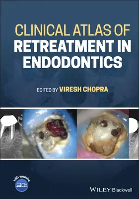 Klinický atlas retreatmentu v endodoncii - Clinical Atlas of Retreatment in Endodontics