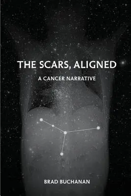 Jizvy, vyrovnané - The Scars, Aligned
