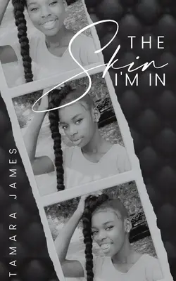 Kůže, ve které jsem - The Skin I'm In