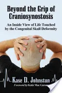 Za hranice kraniosynostózy: Pohled zevnitř na život postižený vrozenou deformací lebky - Beyond the Grip of Craniosynostosis: An Inside View of Life Touched by the Congenital Skull Deformity