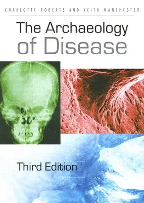 Archeologie nemocí - The Archaeology of Disease