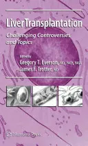 Transplantace jater: Vyzývavé kontroverze a témata - Liver Transplantation: Challenging Controversies and Topics