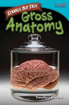 Podivné, ale pravdivé: Hrubá anatomie - Strange but True: Gross Anatomy