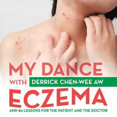 Můj tanec s ekzémem: Tanec s ekzémem: 80 lekcí pro pacienta i lékaře - My Dance with Eczema: And 80 Lessons for the Patient and the Doctor