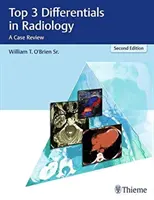Top 3 diferenciály v radiologii: Přehled případů - Top 3 Differentials in Radiology: A Case Review
