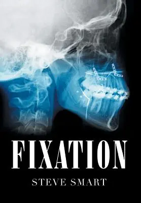 Fixace - Fixation