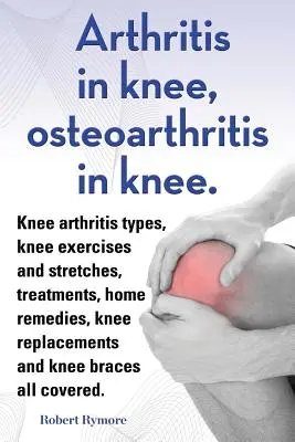 Artritida v koleni, osteoartróza v koleni. Typy artritidy v koleni, cviky a protahování kolene, léčba, domácí prostředky, náhrady kolene a kolenní b - Arthritis in knee, osteoarthritis in knee. Knee arthritis types, knee exercises and stretches, treatments, home remedies, knee replacements and knee b
