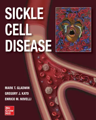 Nemoc srpkovitých buněk - Sickle Cell Disease