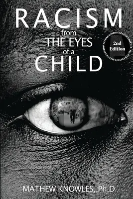 Rasismus očima dítěte - Racism From the Eyes of a Child