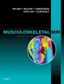 Muskuloskeletální magnetická rezonance - Musculoskeletal MRI