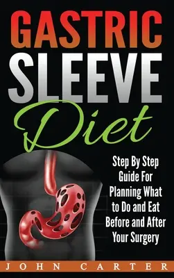 Gastric Sleeve Diet (Dieta se žaludečním rukávem): Vychytávky k plánování toho, co dělat a jíst před operací a po ní: příručka pro pacienty, kteří si chtějí po operaci žaludku dopřát žaludeční šťávu. - Gastric Sleeve Diet: Step By Step Guide For Planning What to Do and Eat Before and After Your Surgery