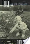 Polio and Its Aftermath: Paralýza kultury - Polio and Its Aftermath: The Paralysis of Culture