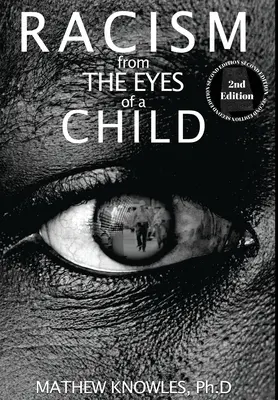Rasismus očima dítěte - Racism From the Eyes of a Child