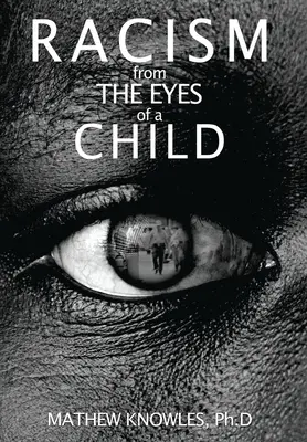 Rasismus očima dítěte - Racism From the Eyes of A Child