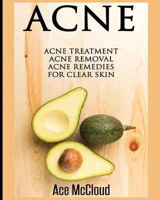 Akné: Léčba akné: Odstranění akné: Léčba akné: Jak na akné: Léky na akné pro čistou pleť - Acne: Acne Treatment: Acne Removal: Acne Remedies For Clear Skin