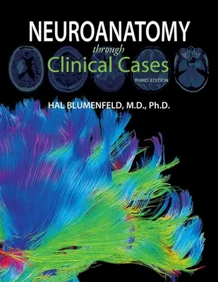 Neuroanatomie prostřednictvím klinických případů - Neuroanatomy Through Clinical Cases