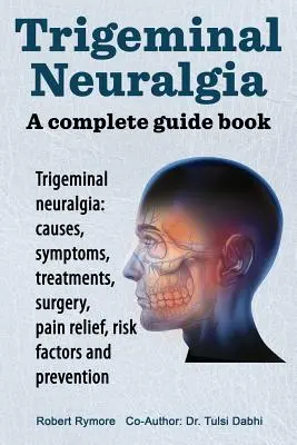 Trigeminální neuralgie: kompletní průvodce. Trigeminální neuralgie: příčiny, příznaky, léčba, operace, - Trigeminal neuralgia: a complete guide book. Trigeminal neuralgia: causes, symptoms, treatments, surgery,