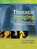 Zobrazování hrudníku: Plicní a kardiovaskulární radiologie. - Thoracic Imaging: Pulmonary and Cardiovascular Radiology