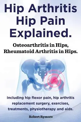 Vysvětlení artritidy kyčelního kloubu, bolesti kyčelního kloubu. Osteoartróza kyčlí, revmatoidní artritida kyčlí. Včetně operace artritidy kyčelního kloubu, bolesti kyčelního kloubu, cvičení, - Hip Arthritis, Hip Pain Explained. Osteoarthritis in Hips, Rheumatoid Arthritis in Hips. Including Hip Arthritis Surgery, Hip Flexor Pain, Exercises,