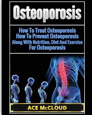 Osteoporóza: Jak léčit osteoporózu: Jak předcházet osteoporóze: Jak na osteoporózu: Spolu s výživou, dietou a cvičením na osteoporózu - Osteoporosis: How To Treat Osteoporosis: How To Prevent Osteoporosis: Along With Nutrition, Diet And Exercise For Osteoporosis