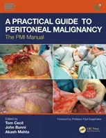 Praktický průvodce peritoneální malignitou: Příručka PMI - A Practical Guide to Peritoneal Malignancy: The PMI Manual