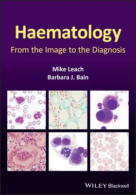 Hematologie: Od obrazu k diagnóze - Haematology: From the Image to the Diagnosis