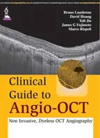 Klinický průvodce angio-OCT: Neinvazivní OCT angiografie bez použití barviva - Clinical Guide to Angio-OCT: Non Invasive, Dyeless OCT Angiography