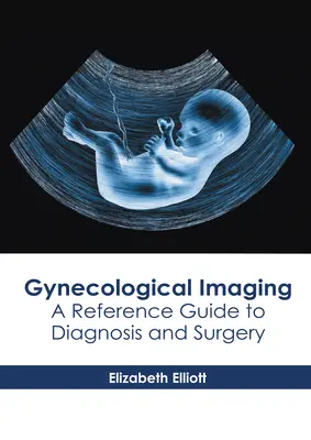 Gynekologické zobrazování: Příručka pro diagnostiku a chirurgii. - Gynecological Imaging: A Reference Guide to Diagnosis and Surgery
