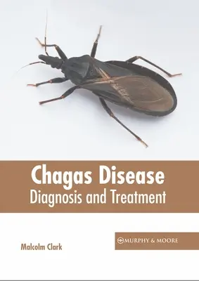 Chagasova choroba: Diagnostika a léčba - Chagas Disease: Diagnosis and Treatment