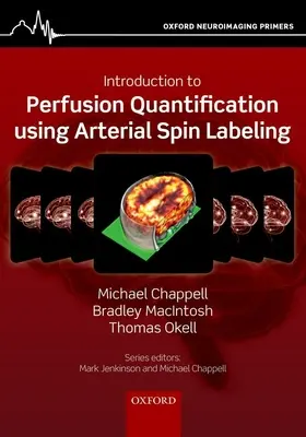 Úvod do kvantifikace perfuze pomocí arteriálního spinového značení - Introduction to Perfusion Quantification Using Arterial Spin Labelling