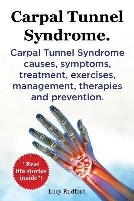 Syndrom karpálního tunelu, Cts. Syndrom karpálního tunelu Cts Příčiny, příznaky, léčba, cvičení, management, terapie a prevence. - Carpal Tunnel Syndrome, Cts. Carpal Tunnel Syndrome Cts Causes, Symptoms, Treatment, Exercises, Management, Therapies and Prevention.