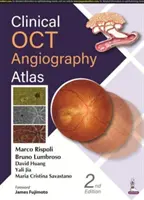 Atlas klinické OCT angiografie - Clinical OCT Angiography Atlas
