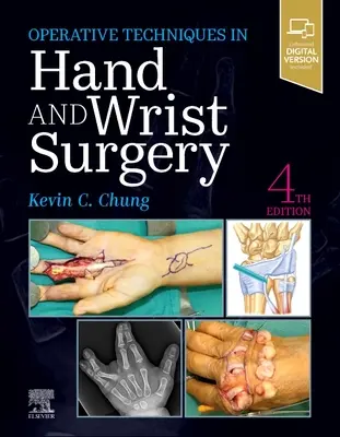 Operační techniky: Chirurgie ruky a zápěstí - Operative Techniques: Hand and Wrist Surgery