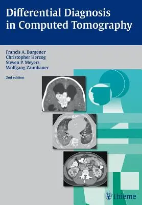 Diferenciální diagnostika v počítačové tomografii - Differential Diagnosis in Computed Tomography