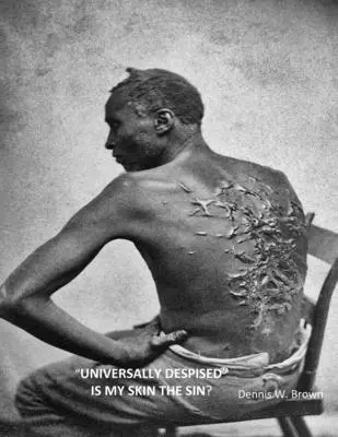 Všeobecně opovrhovaná je moje kůže hříchem? - Universally Despised Is My Skin the Sin?