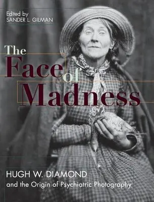 Tvář šílenství: Hugh W. Diamond a vznik psychiatrické fotografie. - Face of Madness: Hugh W. Diamond and the Origin of Psychiatric Photography