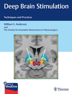 Hluboká mozková stimulace: Stimulování mozku: techniky a postupy - Deep Brain Stimulation: Techniques and Practices