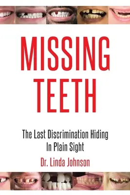 Chybějící zuby: Poslední diskriminace, která se skrývá na první pohled - Missing Teeth: The Last Discrimination Hiding in Plain Sight