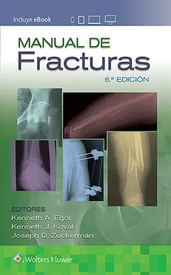 Příručka fraktur - Manual de Fracturas