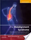 Syndrom špatného sladění: Diagnostika a léčba běžných bolestí pánve a zad - The Malalignment Syndrome: Diagnosis and Treatment of Common Pelvic and Back Pain