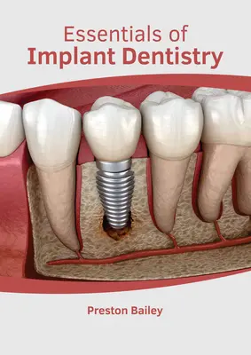 Základy implantologické stomatologie - Essentials of Implant Dentistry