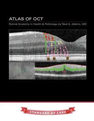 Atlas OCT: Anatomie sítnice ve zdraví a patologii - Atlas of OCT: Retinal Anatomy in Health & Pathology
