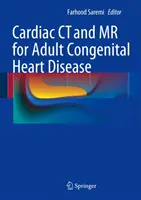 CT a MR srdce u vrozených srdečních vad dospělých - Cardiac CT and MR for Adult Congenital Heart Disease