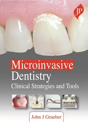 Mikroinvazivní stomatologie - klinické strategie a nástroje - Microinvasive Dentistry - Clinical Strategies and Tools