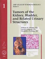 Nádory ledvin, močového měchýře a příbuzných močových struktur - Tumors of the Kidney, Bladder, and Related Urinary Structures